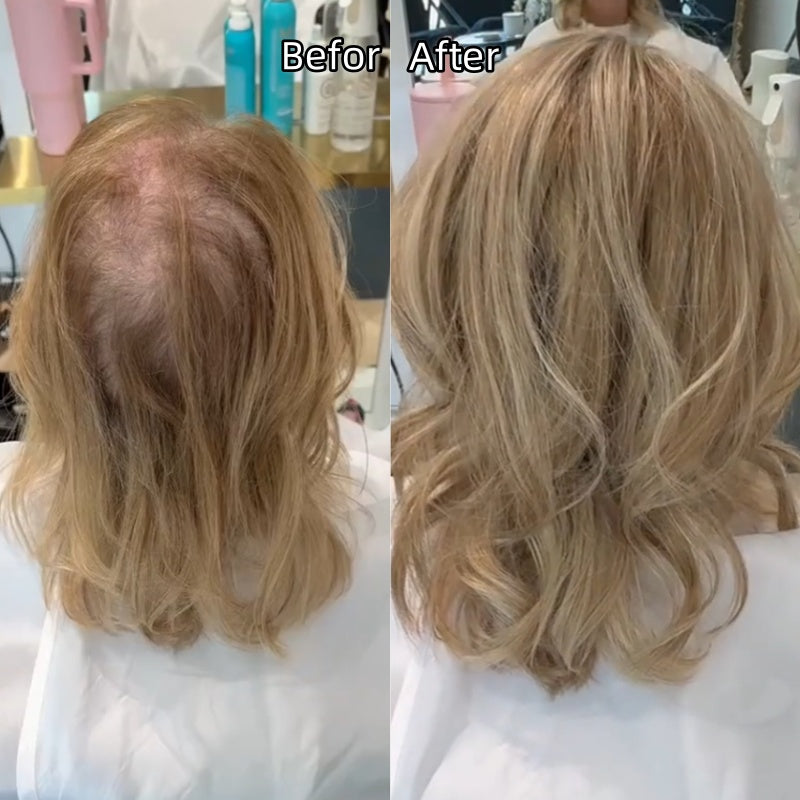 🌷🌷 Final Hours – 58% OFF | Lightweight & Breathable Wavy Hair Topper ✨ Natural Volume, Everyday Confidence